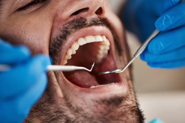 Laser Dentistry in Fairland, OK